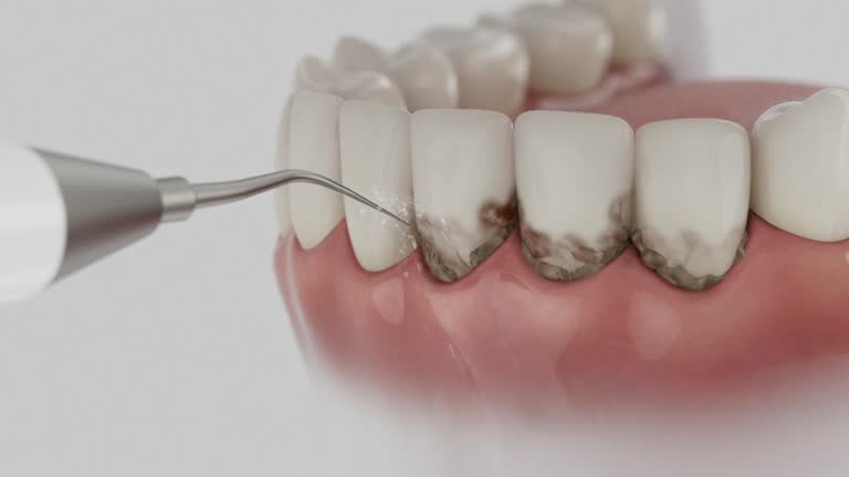 Trusted Dental Implants service in Ortonville, MI - Dentist Open Now